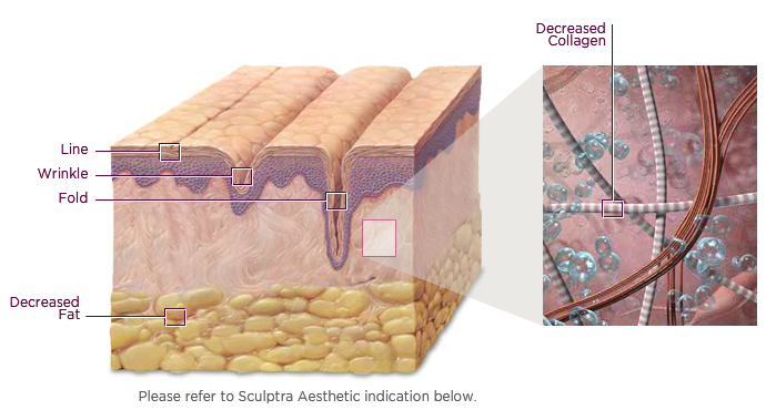 Aging Skin